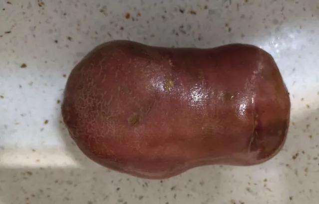 椒盐土豆饼的家常做法（土豆饼怎么做）-1