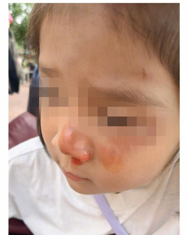 “迪士尼黄牛恶意伤人事件”:上海迪士尼回应:深表歉意,并将为其提供支持
